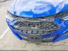 Acura TLX A-spec Package Image 14